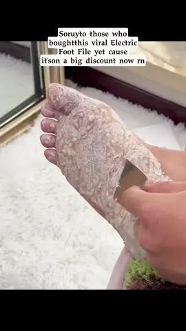 Crusty feet is ugly feet so dont let that be you!! How to remove Callus with the electric foot file! #callus #callusremoval #tiktokshopfinds 