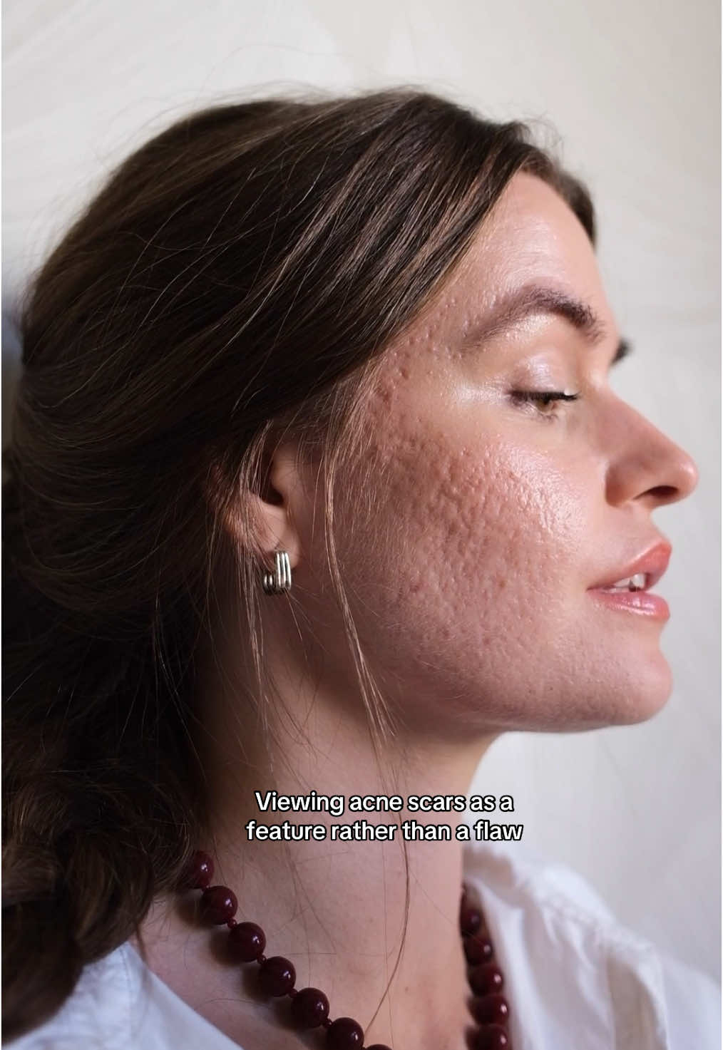 No need to resent skin that just simply healed from acne🫀 #realskin #acnefighter 