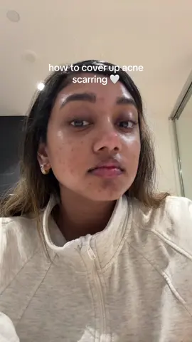 how to cover up acne scars (pigmentaton) with just one product by @NARS Cosmetics ! this is just the first layer i do which i wear on my chill makeup days but if im going somewhere i do go over this with a foundation/skin tint to make them all completely disappear ! #narssoftmatteconcealer #howtocoveracne #browngirlfriendlymakeup 