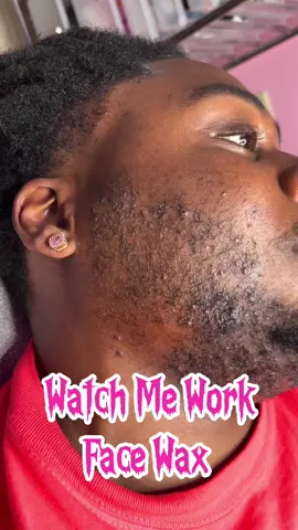 💆‍♂️ Men Need Smooth Skin Too! It’s not just about the ladies! A face wax for men can make a world of difference in both appearance and confidence. Whether it’s for a cleaner shave line, reducing irritation, or keeping that skin smooth, facial waxing is the game-changer you’ve been missing. Today’s client left with smooth, fresh skin—and no irritation! If you’re ready to say goodbye to ingrown hairs and uneven facial hair growth, it’s time to book your appointment! ✨ Click the link in our bio to book with Doris and experience the benefits yourself! #facewax #atlwaxspecialist #esthetician #atlanta #atlantaesthetician #clearskin #ingrownhair #malewaxing 