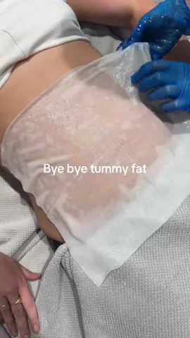 #fatfreezing #health #body #fyp #fypシ゚viral