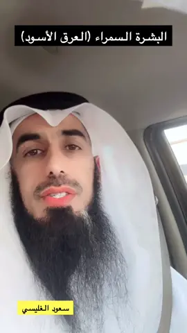 ##سعود_الغليسي #العرق_الاسود #البشرة_السمراء #الاسود #العنصرية #التعصب   #التربية #نصائح