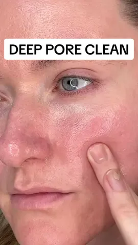 DEEP PORE CLEAN! 💦  using @Kiehlsuki @Kiehl's Since 1851 Rare Earth Deep Pore Mask and @La Roche-Posay Cicaplast Baume B5  la roche posay cicaplast pores sebaceous filaments • kiehls rare earth pore mask • big pores products #skincare 