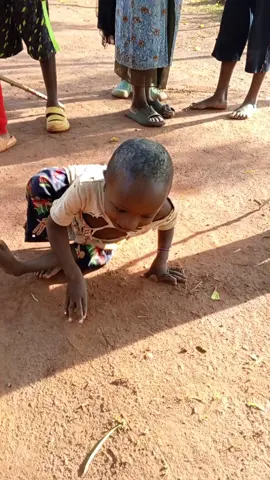 Urgent Help  Needed🚨  Give Zilatan a Chance at a Better Life Dear valued donors and supporters, I'm reaching out with a heavy heart, seeking your compassion and support for Zilatan, a young child struggling to overcome incredible challenges Zilatan's Story This brave child is lame and faces unimaginable difficulties daily, especially when using the latrine or attending school. The simplest tasks become daunting obstacles, affecting their dignity and self esteem *We Can Make a Difference Your kindness can change Zilatan's life forever. We're raising funds for a wheelchair, ensuring Dignity and independence Access to education. Improved quality of life *Every Little Bit Counts! Join me in raising $1000 for Zilatan's wheelchair and supporting other children in need. Your contribution, big or small, brings us closer to our goal *Donate Today kindly click into the link in bio to donate 🙏🏻  Together, We Can Restore Zilatan's hope Empower their future Create a ripple effect of kindness Let's unite to give Zilatan the chance they deserve. Please share this appeal with others and consider donating generously #ZilatansDream #DisabilityIsNotInability #WheelchairForZilatan #MakeADifference #DonateNow