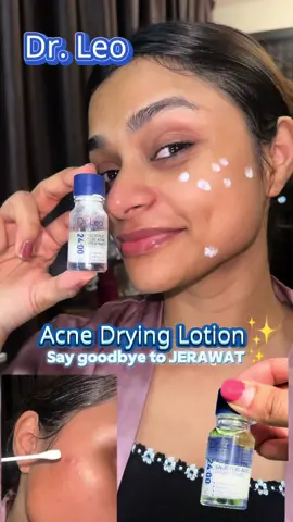 Kecut pun jerawat! Dr.Leo Acne Lotion✨ #drleo #drleoMY #AcneBuster #AcneSolution #BlemishFree #acnetreatment #yezmine✨ @Dr.Leo Skincare MY 