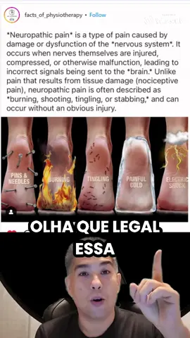 🧠⚠️ 5 Tipos de Dor Neuropática que Você Precisa Conhecer 🧠⚠️ Descubra os 5 principais tipos de dor neuropática, como agulhamento, queimação, formigamento, sensação de frio e choques elétricos, e entenda melhor como eles podem afetar o cérebro e o sistema nervoso. #DorNeuropática #SaúdeNeurológica #SintamasDores #CuidadosDeSaúde #TiposDeDesconforto