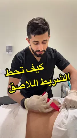 #الشريط_اللاصق #التورمات #كدمات #ورم 