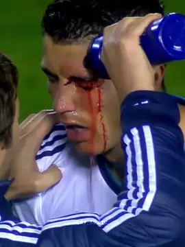 O DIA QUE CR7 MACHUCOU O OLHO E AINDA FEZ GOL 🔥☠️ #cristianoronaldo #cr7 #vaiprofycaramba #viraltiktok #entregatiktok 