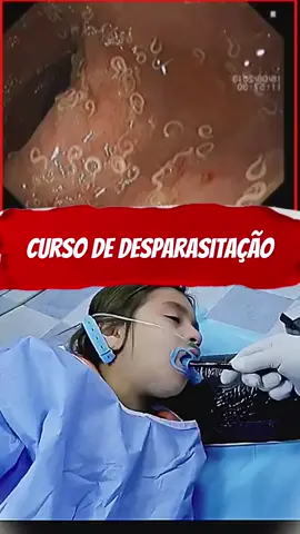 Curso de Desparasitação #desparasitantenatural #vermes #solitaria #tenia #lombriga 