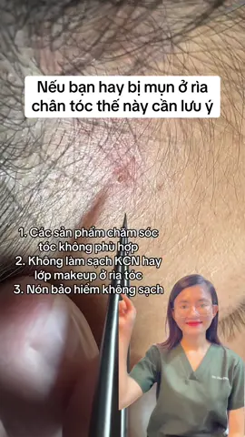 Mụn rìa chân tóc #bsthuphong #LearnOnTikTok #trimun #bacsidalieu #xuhuong 