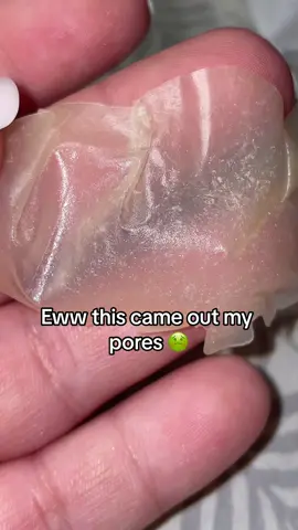 My Pores Are Thanking Me Right Now 🤣🤭 Worth The $9 Spend! #fyp#hygiene#pores#facial#TikTokShop#viralproducts#giftsforher#giftsforhim#SelfCare#fypシ 