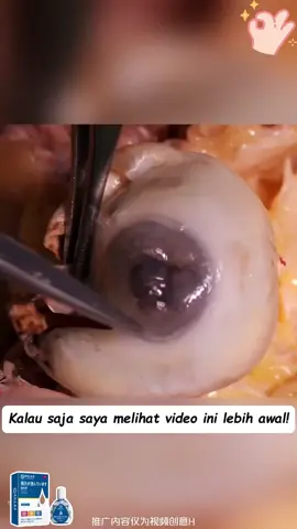 Cukup satu tetes saja sudah bisa meredakan penglihatan kabur, yang direkomendasikan oleh rumah sakit Singapura! Acara diskon 50% waktu terbatas