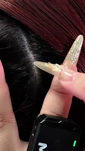 ASMR Ultimate Dandruff Cleaning: Hand And Comb ASMR Sounds #dandruff #asmr #asmrsounds #asmrsleep #relaxing #relaxation #dandruffremovel #scalp #scalping #notalking #asmrvideo #combing #asmrcleaning 