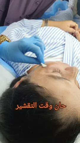 الخريف هو وقت التقشير الكيميائي  #algerienne #شاويات_الجزائر #syabeautyclinic #peeling #تقشير_البشرة #تقشير_كيميائي #peelingskin #خنشلة_باتنة_ام_البواقي_سطيف_شاوية #طبيبة_تجميل #عين_بيضاء #الشعب_الصيني_ماله_حل😂😂 