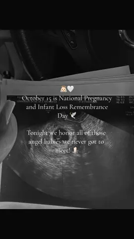 Not a day goes by where I do not think of you and who you would have been. I’ll see you again. One day. 👼🏻🕯️🤍 #october15 #nationalpregnancyandinfantlossday #misscarriageawareness #pregnacyloss #angelbaby #fyp #CapCut 