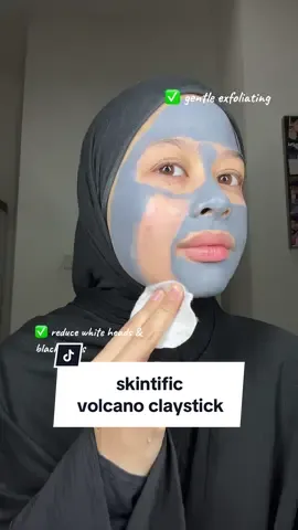 tips to remove blackheads & whiteheads #volcanoclaystick #skintficClaystick #pores #blackhead #acne #porecleanse  #Alaskavolcano #greystick