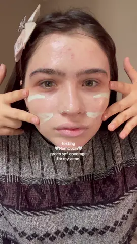 Acc i like it 👻 #kbeauty #koreanskincare #numbuzin #acne 