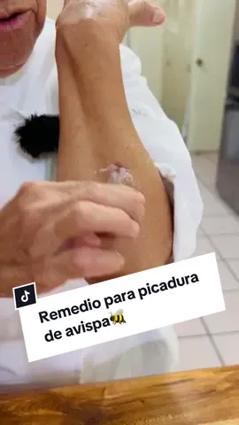Mis hijos, hoy quiero mostrarles este remedio que yo uso para las picadiras de avispa, ya que puede pasar en cualquier momento y si le pasa a uno de nuestros hijos ya no sabemos que hacer, veran como este remedio les ayuda mucho, los quiero!!! #tiktokforgood #TikTok_Partner #alacocinaconjacobina #tipdealacocinaconjacobina #tips #remedioscaseros #picaduras #avispa #tipsdemoda #remedios #remediosnaturales 