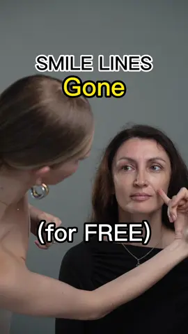 remove SMILE LINES in 14 days!😱 What do you think of Laura’s results? Instead of getting fillers, look at the dynamic of facial muscles. Smile lines and nasolabial folds are caused by tension in muscles that impair blood flow and restrict lymph outflow from the face. Lymph gets accumulated, muscles shorten and skin gets folded to the center of the face, causing folds or lines. To relax muscles, remove lymph, we need to do face fitness. I’ll teach you how in my upcoming workshop! Comment below what you think of her transformation? #smilelines #nasolabialfolds #glowupchallenge #facefitness #facialmassage  Disclaimer: not a medical advice. For education purpose only. Consult with your physician if you have a medical condition.