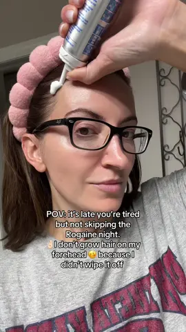 Men’s Rogaine foam for the win! Less irritation with the foam 🫶🏼 ✨Have you tried it yet? #hairlossremedy #minoxidil #rogaine #alopecia #dermtips #hairtok 