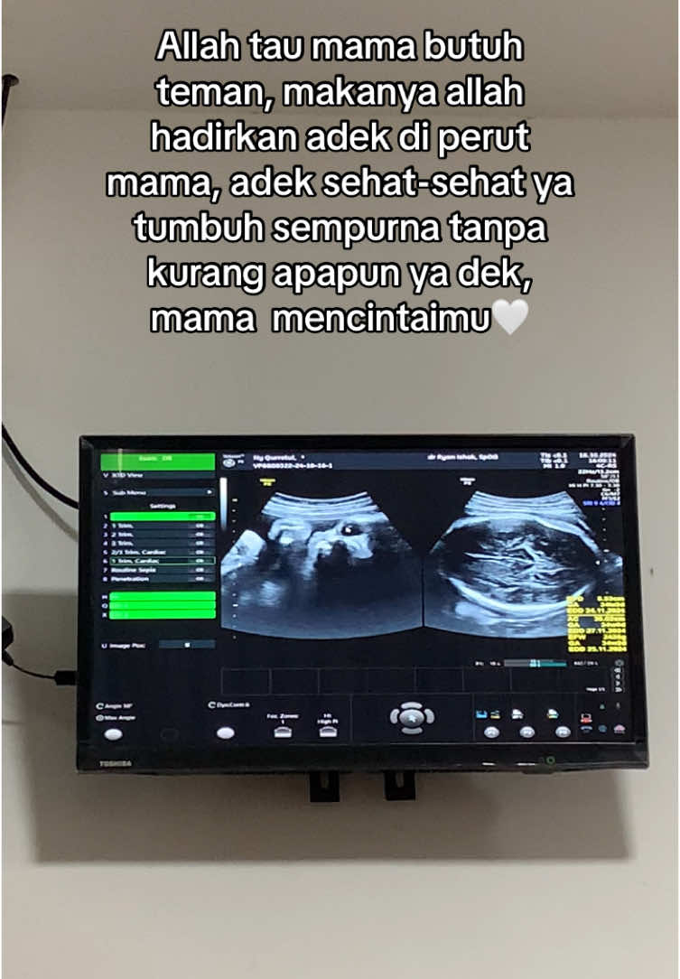Waktunya semakin dekat, perjuangan itu akan segera tiba. Pintaku cuma satu ya rabb, selamatkan aku dan anakku🤲🏻 #bumilhappy #bumiltm3 #trimester3 #pregnant #ibuhamil #masyaallahtabarakkallah 