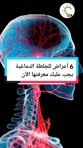 أعراض الجلطة الدماغية  #الجلطة_الدماغية #صحة_عامة #طبيب_تيك_توك #الكبد_الدهني  أسباب الجلطة الدماغية، أعراض الجلطة القلبية، أعراض الجلطة الدماغية المبكرة، سبب الجلطة الدماغية، علاج الجلطة الدماغية، فترة الإستشفاء من الجلطة الدماغية