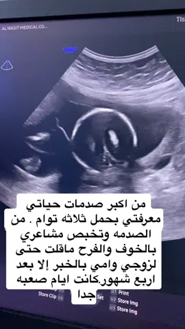 #توام ثلاثي#نعم ربي #اكسبلورexplore #وتشاء_أنت_من_البشائر_قطرةً #babytiktok 