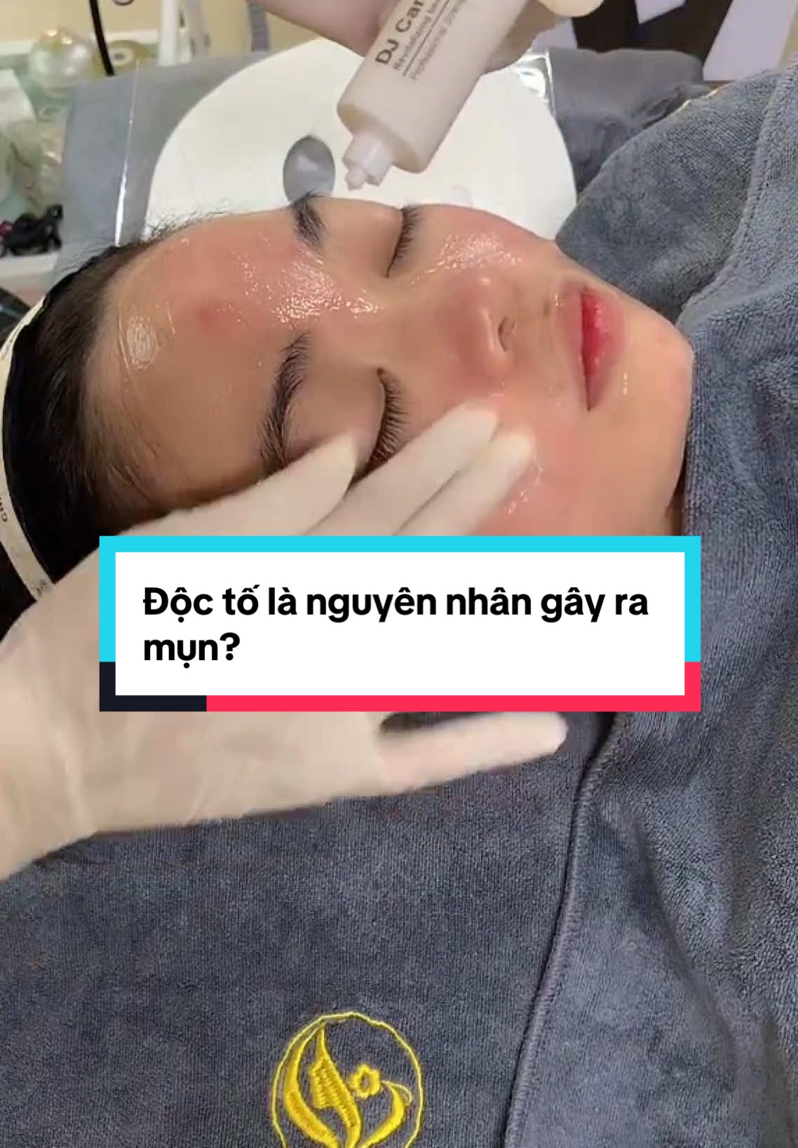 Nếu việc làm sạch chưa tốt và khi soi da thấy biểu hiện da của bạn có nhiễm độc thì việc cần làm ngay lúc này đấy chính là Thải Độc gấp ạ!!! Như em k này nhà Hằng tìm ra đúng nguyên nhân mặt em ấy bị bùng mụn, mới thải độc có 1 buổi mà mặt giảm mụn rõ rẹt luôn đấy ạ!!