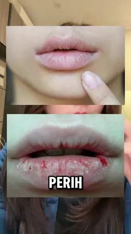 Daripada scrub bibir cape2 nyiapinnya, pake #VaselineLip yang emang udah teruji ampuh dan ada formula #48HourMoisturization jadi bisa ngelembapin bibir seharian deh 💙