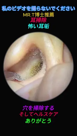 relax with me #cleaning #relax #satisfying #earwax #ear #earwaxremoval 