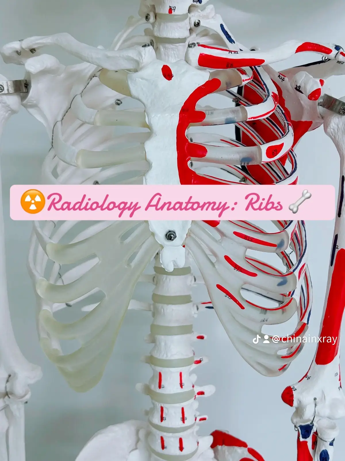 Anatomy is life now 😂 #fyp #foryoupage #xray #xraytech #travelxraytech #traveltech #xrayschool #radtech #radtechstudent #travelradtech #radtok #xraytok #radiologictechnogist #radiologytechnologist #radiology #mylifebelike #mylife #sociallife #collegestudent #26yearsold #mri #mritech #ayahealthcare #canva #miniinfluencer #creatormarketplace #influencer #sketchers #nucmed #cttech #ct #cathlab #cathlabtech #ultrasound #pediatrics #radiologist #medschool #blackwomenintech #blackwomeninmedicine #blackgirlluxury #sixfigures #classof2025 #studytokaesthetic #studytok #neworleans #louisiana #georgia #atlanta #namethisxray #chinainxray #china #texas #lsu #lsue #radiation #radiationtherapy #nursing #nursingstudent #lpn #rn #fnp #blackgirlsinradiology 
