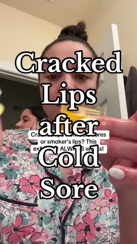 I love how my lips feel #lipscrub #naturalscrub #crackedlips  #tiktokshopmothersday #TTSACL #tiktokshop #fyp #tiktokshopblackfriday #viral  #tiktokshopcybermonday #foryou #tiktokmademebuyit #foryoupage #TTSCreatorBash #foryourpage #musthaves #viraltiktok #tiktokshopholidaydeals #springcleaning #wellness #TikTokShopSummerSale #dealdash #tiktokshopmemorialday #tiktokshopsummersale #tiktokshopping #summerstyle #dealsforyoudays #beautysuperstars #supergroupday #sunkissedsummer #tiktokshopbacktoschool #rushready #elevateyourhome #laborday #falldealsforyou #treasurefinds #BTSBeautyTTS#ttslevelup #Tiktokshopnewarrivals #TikTokShopNewArrivals #TTSbrandday #langetok #treasurefinds  #falldealsforyou #SelfCare  #TikTokSuperBrandDay #SuperBrandDay #sunsetsavings #makeupforevernewarrivals #Tiktokshopnewarrivals #falldealsforyou #tiktokshopblackfriday #toktokshopping #tiktokshopchristmas #tiktokshopholidayhaul