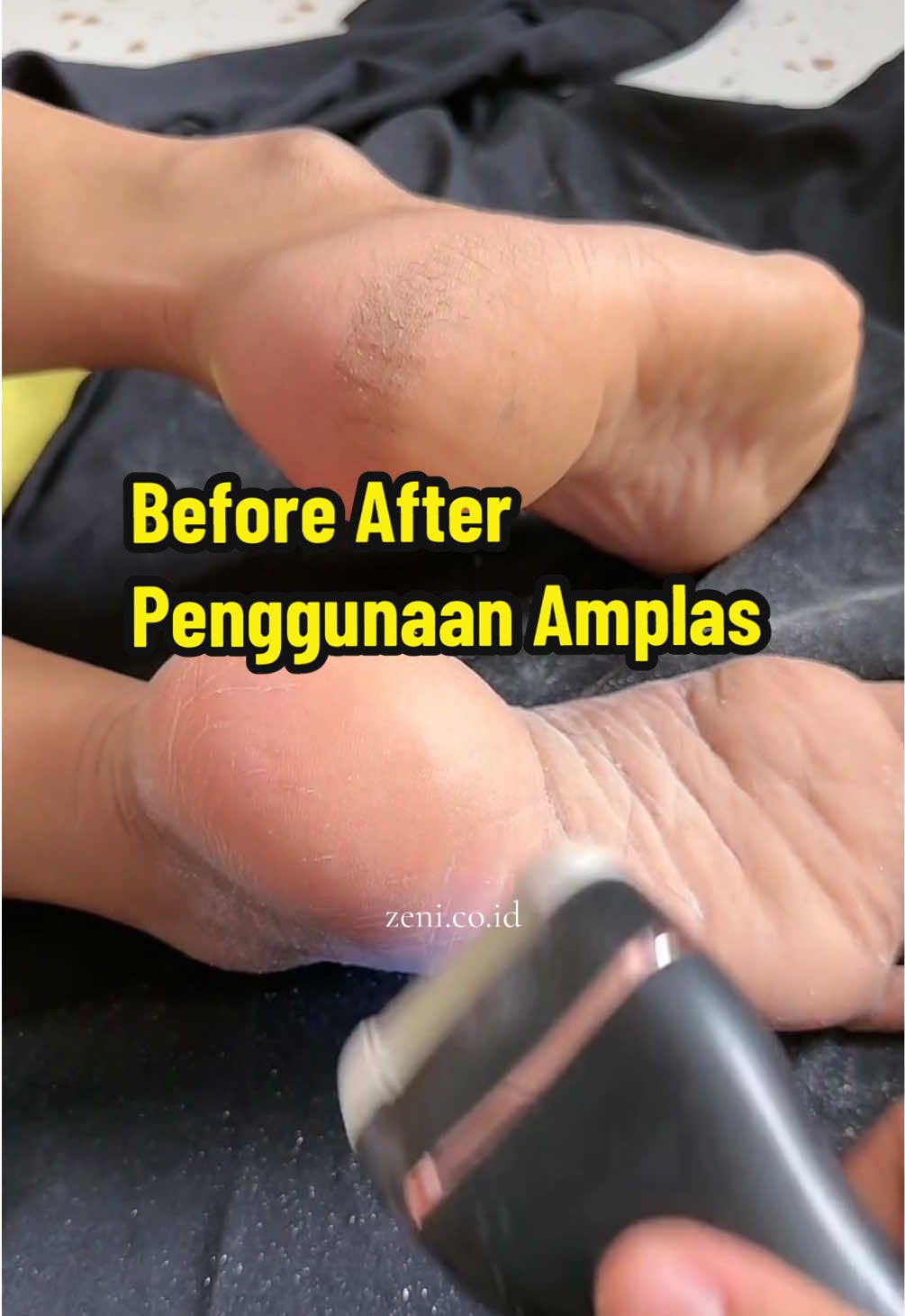 , udah 2th pakai amplas kaki ini, dari yg awalnya ga viral sekarang jd viral banget gara2 tumit kaki wkwkw  #penghaluskaki #penghalustumit #tumitku 