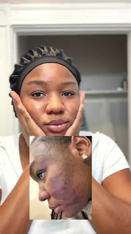 My honest review on the AXIS-Y community choice set. I dont know how i feel how the sunscreen aside that every other product was just tooo good on my skin😍🤎#communitychoicesetaxisy #axisydarkspotcorrectingglowserum #axisysunscreen #CapCut 