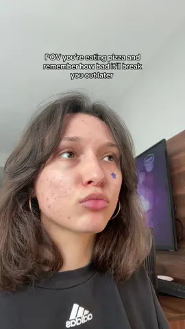 Maturing is realizing you should enjoy the foods you love in moderation even tho ur acne prone <3  #acneproneskin #acneproblems #breakouts #skincare 