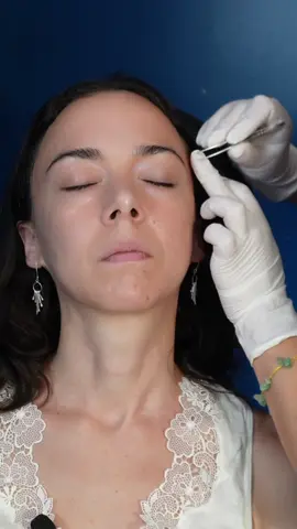 ASMR part 41:  face and scalp examination for  @ilovekatieasmr | sharp or dull tests medical roleplay for sleep #madpasmr #asmrhead #asmrface #asmrfacetouching #asmrmedical #asmrmedicalroleplay #asmrmedicalexam #asmrdoctor #asmrdoctorroleplay #asmrrealperson #asmr #asmrsounds #asmrsensory #asmrroleplay #asmrvideo