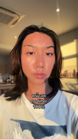 อัพเดตผิวหลังลอง Juvelook ที่ @ey clinic 🌚 #juvelook #รีวิวบิวตี้ #รีวิวบิวตี้ในtiktok #หน้าสด 