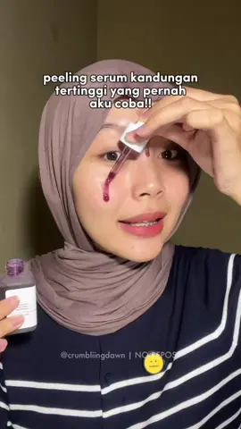 APA LAGI NIH 😭🫵 facetolology sekalinya launch 13.5%!!! #peelingserum #serumungu #peelingfacetology #fyp 