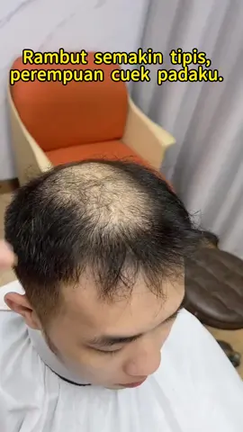 Jika anda juga menderita #rontokrambut ,rambut menipis,bercabang lebar,garis rambut surut,cobalah #antihairfall #shampoo ini 