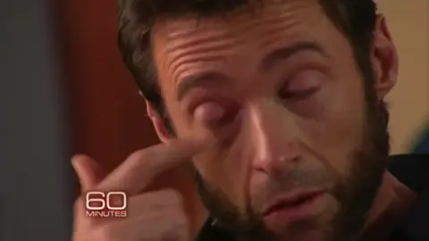 ##hughjackman #wolverine #logan 