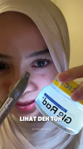 nahh ini moisturizer emina biru namanya emina glo rad moist gel🫶🏻 dia bisa buat instant soothing, trus feels pas dipake jg bikin 10X glowing😚 oiya ini juga gong sih buat 5 level skin barrier #moisturizer #skincare #moisturizerviral #glowguaranteed @Emina Store 