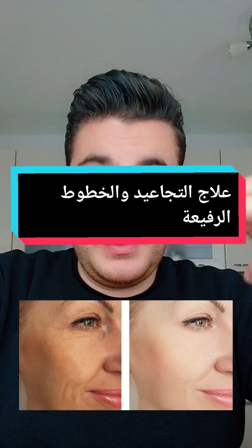 علاج إزالة التجاعيد والخطوط الرفيعة  #بشرة_صافية #سام #بشرة #بشرة_صحية #تجاعيد #تجاعيد_الوجه #علاج #اعشاب_طبيعيه_فوائد #علاج_طبيعي #علاج_بالاعشاب #اعشاب #لبان_الذكر #الصمغ_العربي_الهشاب 