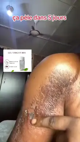 Le gel est disponible à partir de 500f en gros #gelpeeling #visibilité #grossiste #viralvideos @Grachoux14 