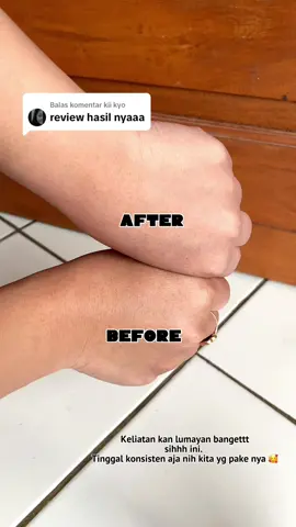 Membalas @kii kyo  Aku sih yesss yaa hihihi tone up nya ga lebay loh 😍 #kojiesan #bodylotion #kojiesanbodylotion #bodycare #brightening #cuantanpabatas #tiktok #fyp 