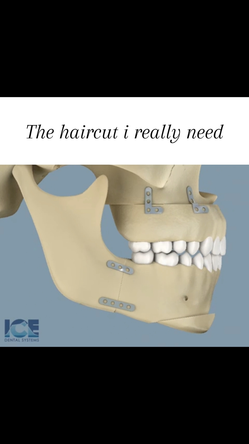 yeah no caption. #real #fyp #foryoupage #foryou #surgery #beauty #Love #height #short #tall #ugly #handsome #jawline #mogging #looksmax 