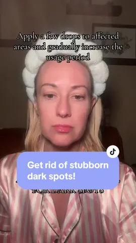 I have never used a serum that has diminished stubborn dark spots this well until I found Anua. This makes my skin glow all day and has helped with hyperpigmentation on my face and chest.  #anua #anuaskincare #anuadarkspotcorrectingserum #anuadarkspotserum #anuadarkspotsserum #darkspottreatment #darkspotsonface #darkspotremoval #faceserum #skincare #skincareroutine #skincaretips #koreanskincare #viralvideo #viralskincare 