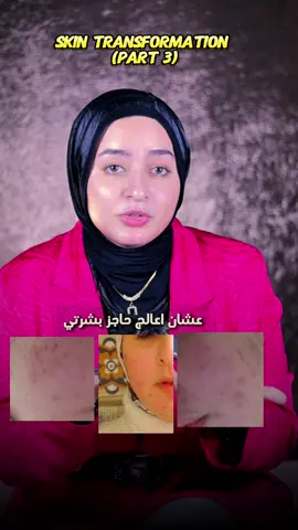 يعني ايه اصلا حاجز البشره ازاي عالجت حاجز بشرتي في ٤ خطوات بس !✨   متنسوش تعملواي منشن فالاستوري وتحطوا الهاشتاجين دول لو عايزين تكسبوا ف اهر التحدي 😍  #glowwithdrmennaali #30daynomakeup  #ترميم_حاجز_البشرة  #روتين_العناية_بالبشرة  #مصر🇪🇬  #السعودية🇸🇦 