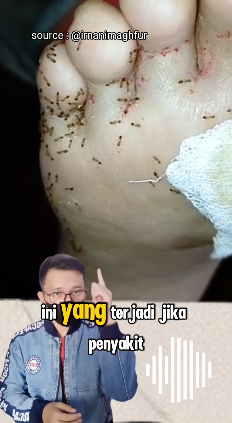 kencing manis / diabetes #viral #funfacts #kesehatan #info 