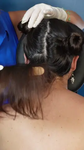 ASMR part 66: face and scalp examination for  @ilovekatieasmr | sharp or dull tests medical roleplay for sleep #madpasmr #asmrhead #asmrface #asmrfacetouching #asmrmedical #asmrmedicalroleplay #asmrmedicalexam #asmrdoctor #asmrdoctorroleplay #asmrrealperson #asmr #asmrsounds #asmrsensory #asmrroleplay #asmrvideo