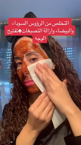 #وصفة #طبيعية #ازالة #رؤوس #سوداء #ازالة #رؤوس #بيضاء #التخلص #من #تصبغات #الوجه #تفتيح #البشرة